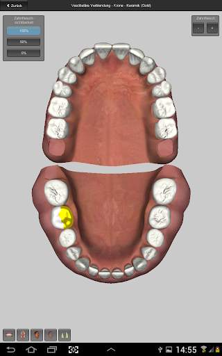 CGM VISODENT 3D App screenshot 4