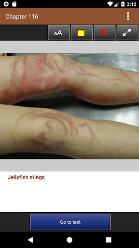 Lebwohl's Treatment of Skin Disease, 5th Edition screenshot 6
