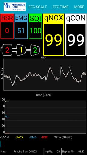 Conox View screenshot 1