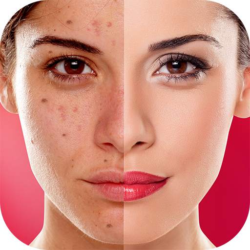 Face Blemishes Cleaner & Photo Scars Remover 1.3