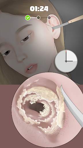 Ear Cleaning Master screenshot 1