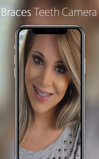 Braces Teeth Camera screenshot 1