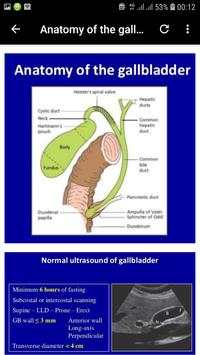 abdominal ultrasound of gallbladder скриншот 3