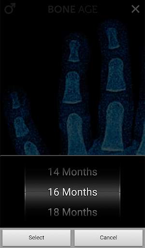 Bone Age Lite screenshot 10