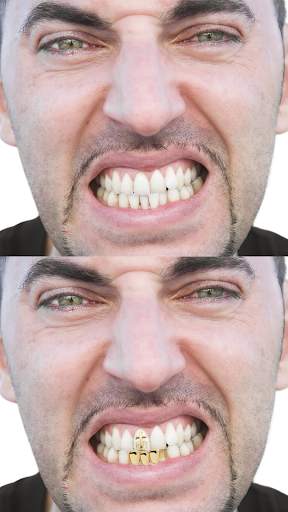 Gold Teeth Photo Editor screenshot 4
