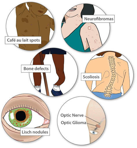 Genetic Disorders скриншот 1