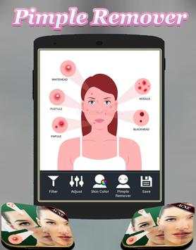 Acne Remover Photo Editor - Pimple remover screenshot 2