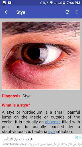 Ophthalmology & Optometry Guide screenshot 1
