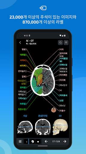e-Anatomy screenshot 2