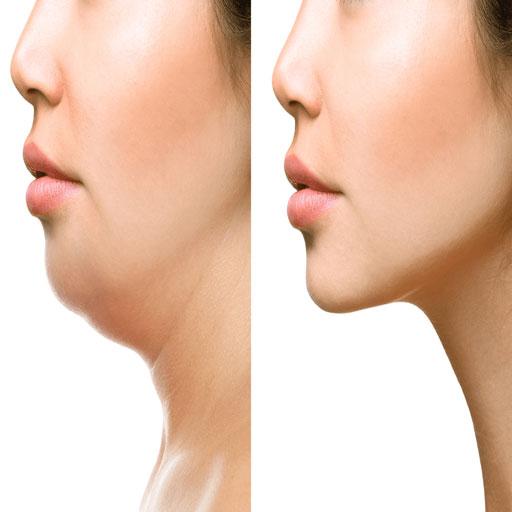 How To Lose Face Fat icon