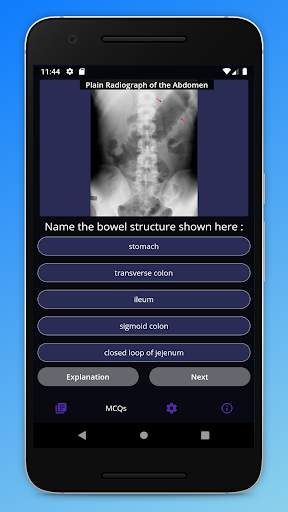 Basic Radiology for medical students screenshot 4