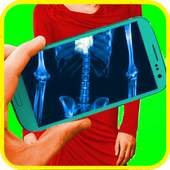 XRay scanner Camera 1.55