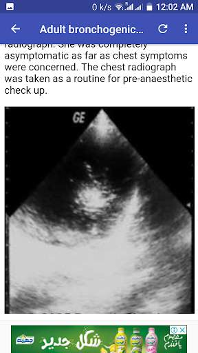 Ultrasound Guide A2Z 8 تصوير الشاشة