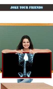X-ray Scanner Funny Prank screenshot 1