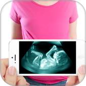 Ultrasound X-ray Scanner Prank 1.0