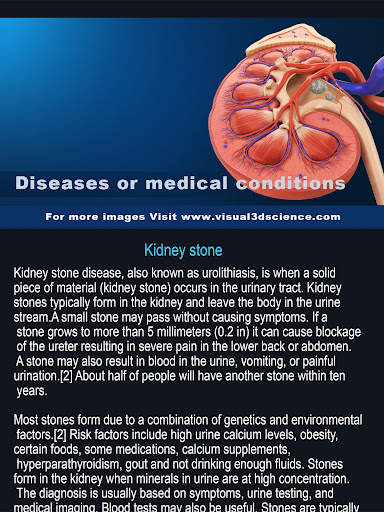 My Urinary System screenshot 8