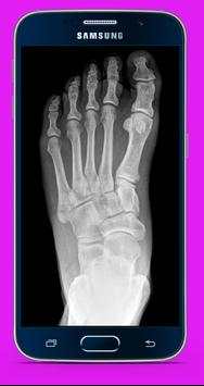 X X Ray Scanner App Prank screenshot 4