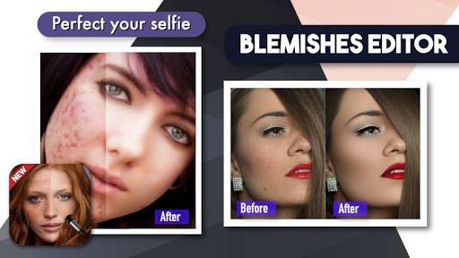 Camera Blemishes Removal Makeup Editor screenshot 1