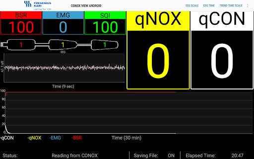 Conox View screenshot 9