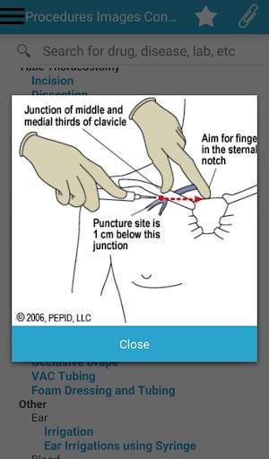 PEPID for Android screenshot 5