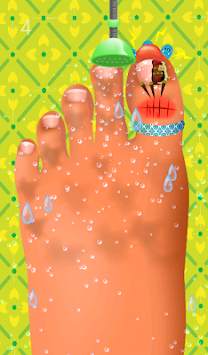 Feet Hospital Operating Games screenshot 2