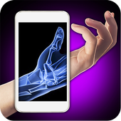 Xray Fracture Hand Prank icon
