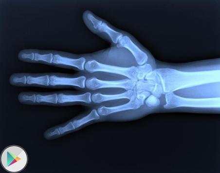 X-Ray clothes Scanner Prank screenshot 2