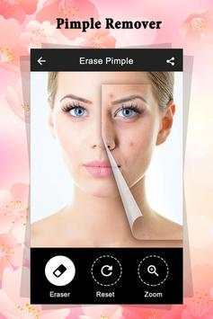 Pimple Remover : Beauty Plus screenshot 5