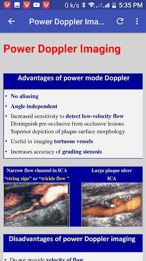 Doppler Ultrasound screenshot 3