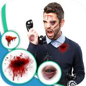 Injury Photo Editor 3.0