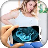Ultrasound X-ray Scanner Prank 1.3