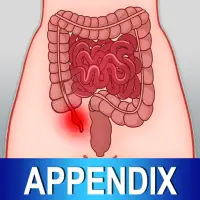 ikon Appendix Diet Foods Help Tips