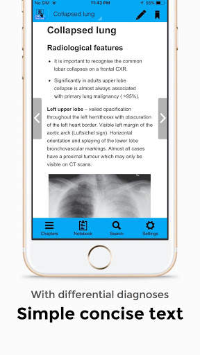 CXR FlashCards - Reference app for Chest X-rays screenshot 2