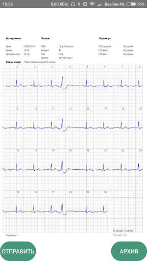 ECG mob скриншот 6