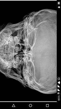 X - Ray Scanner Prank screenshot 5