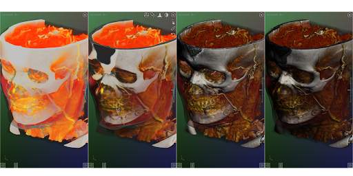 DroidRender - 3D DICOM viewer स्क्रीनशॉट 11