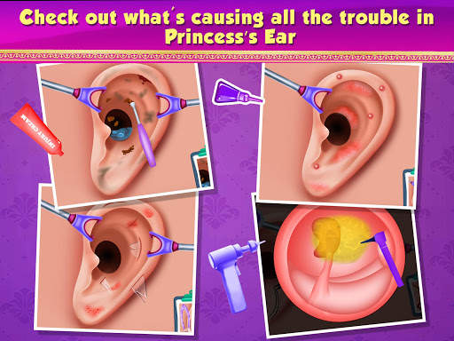Princess ENT Doctor Hospital - Surgery Simulator screenshot 2