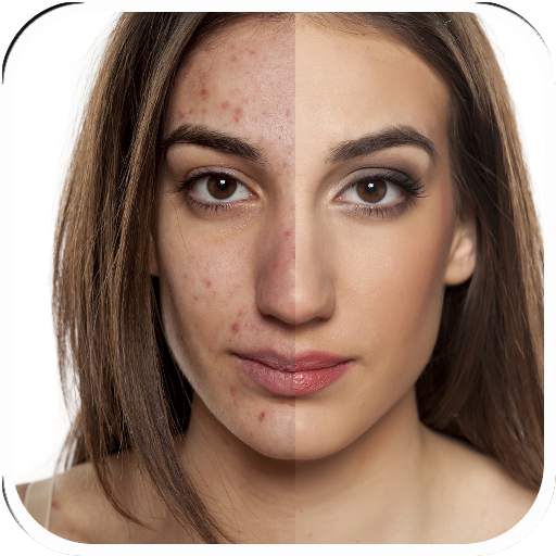 Pimple Eraser Photo Editor 2.1