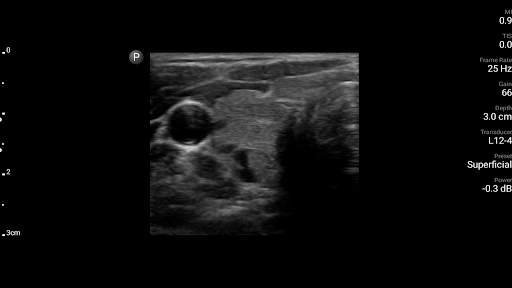 Philips Lumify Ultrasound App screenshot 6