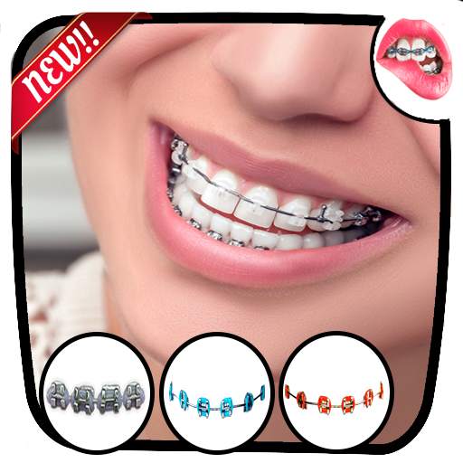 Braces Teeth  Photo Editor 1.3