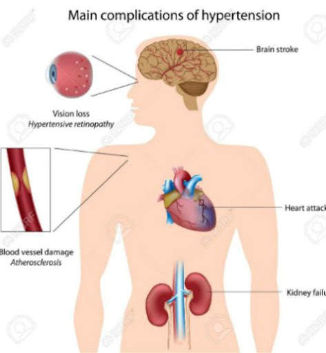 High Blood Pressure tips screenshot 2