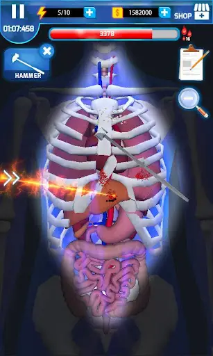Master operasi - Surgery Maste screenshot 2