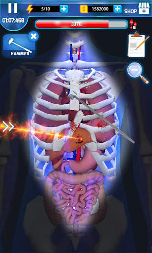 อาจารย์ผ่าตัด - Surgery Master screenshot 2