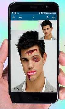 Injury Photo Editor-Fake Injury Photo Editor 2019 screenshot 1