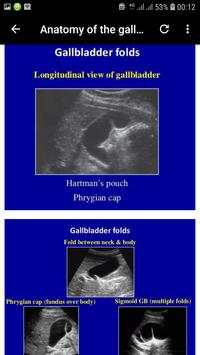 abdominal ultrasound of gallbladder скриншот 4
