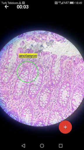 Telepathology Mobile Systems screenshot 5