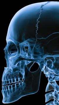 X-Ray Scanner screenshot 4