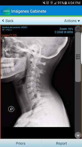 Chopo Mobile screenshot 5