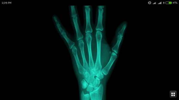 X-ray Cloth Scanner Prank screenshot 5