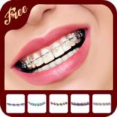 Braces Teeth Camera 2.0